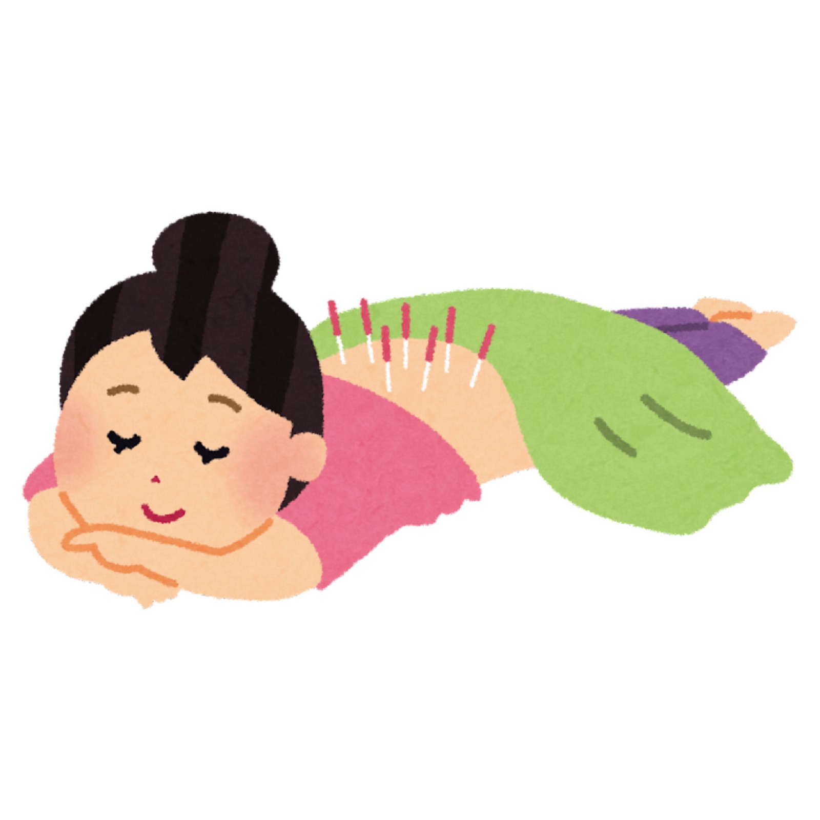 Acupuncture as a concept for holistic therapy