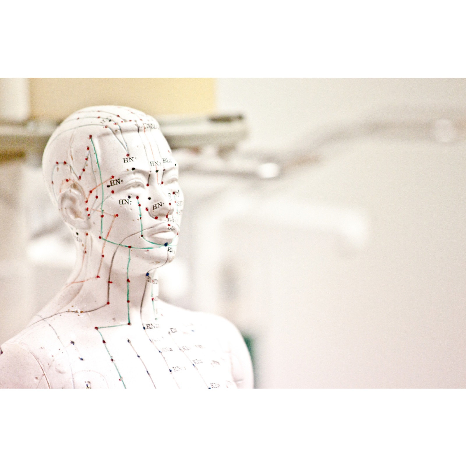 Acupuncture therapy in Berlin