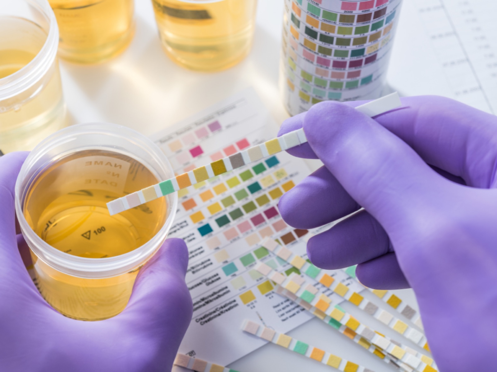 Natura Heilpraxis magazine: urine test