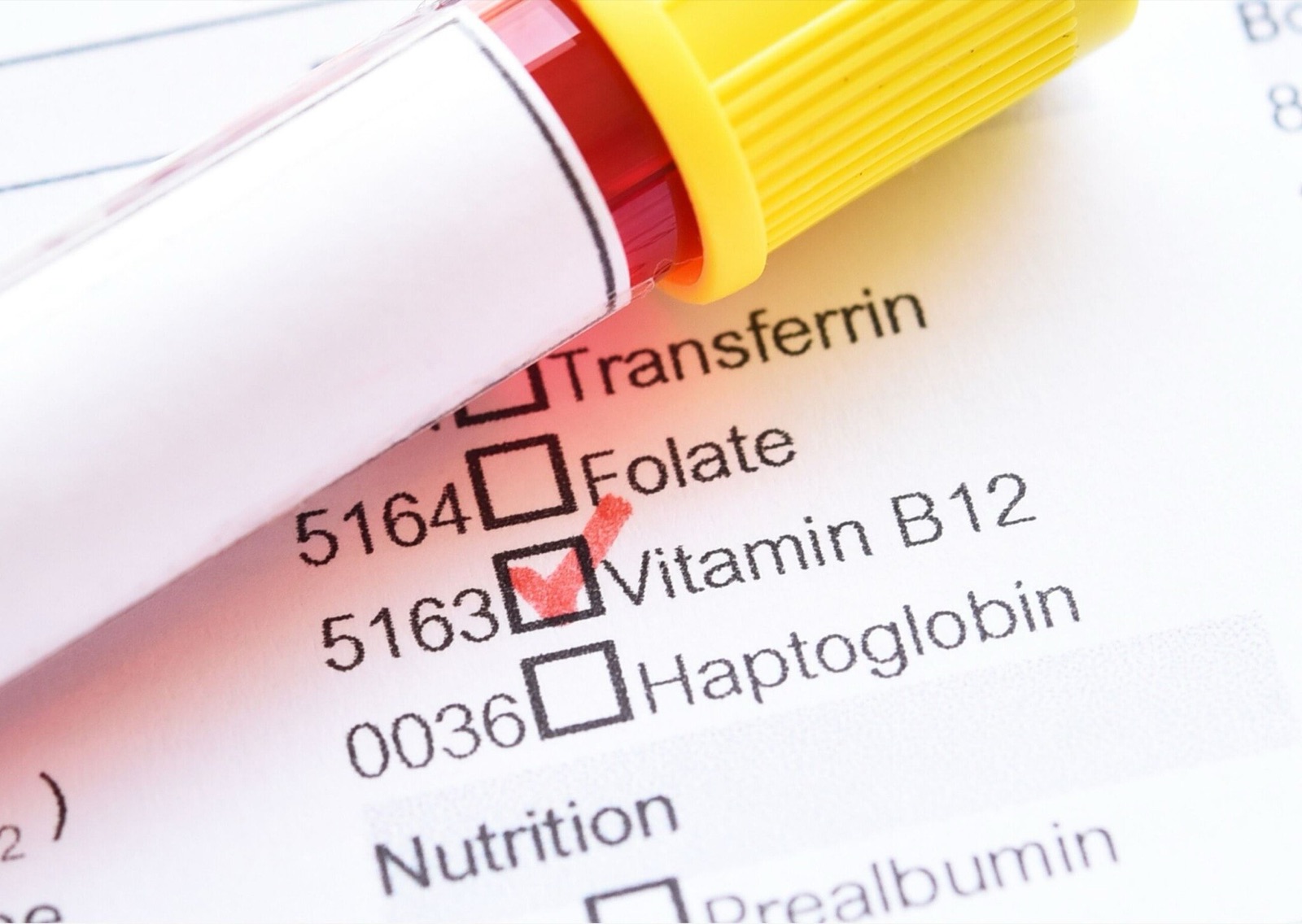 Blood test with a red blood cell and a blue blood globulin, pipette on a medical report with checkboxes for vitamins and nutrients