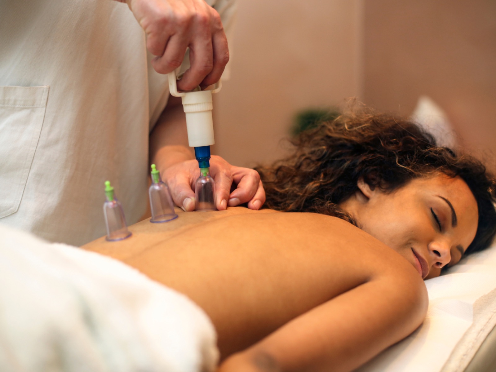 Cupping