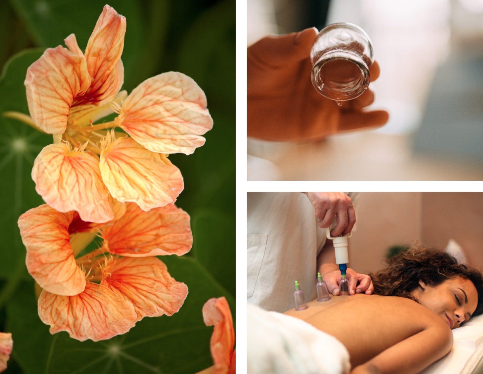 Cupping therapy in Berlin
