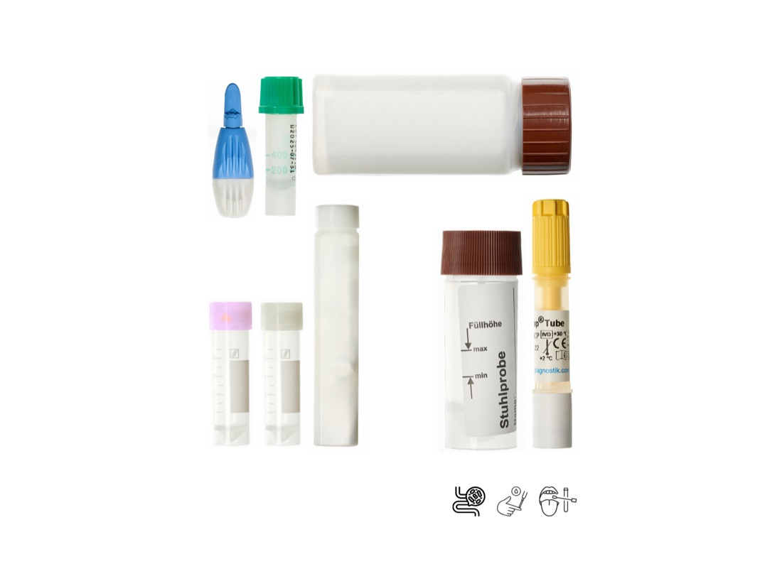 Test kits for at-home laboratory diagnostics